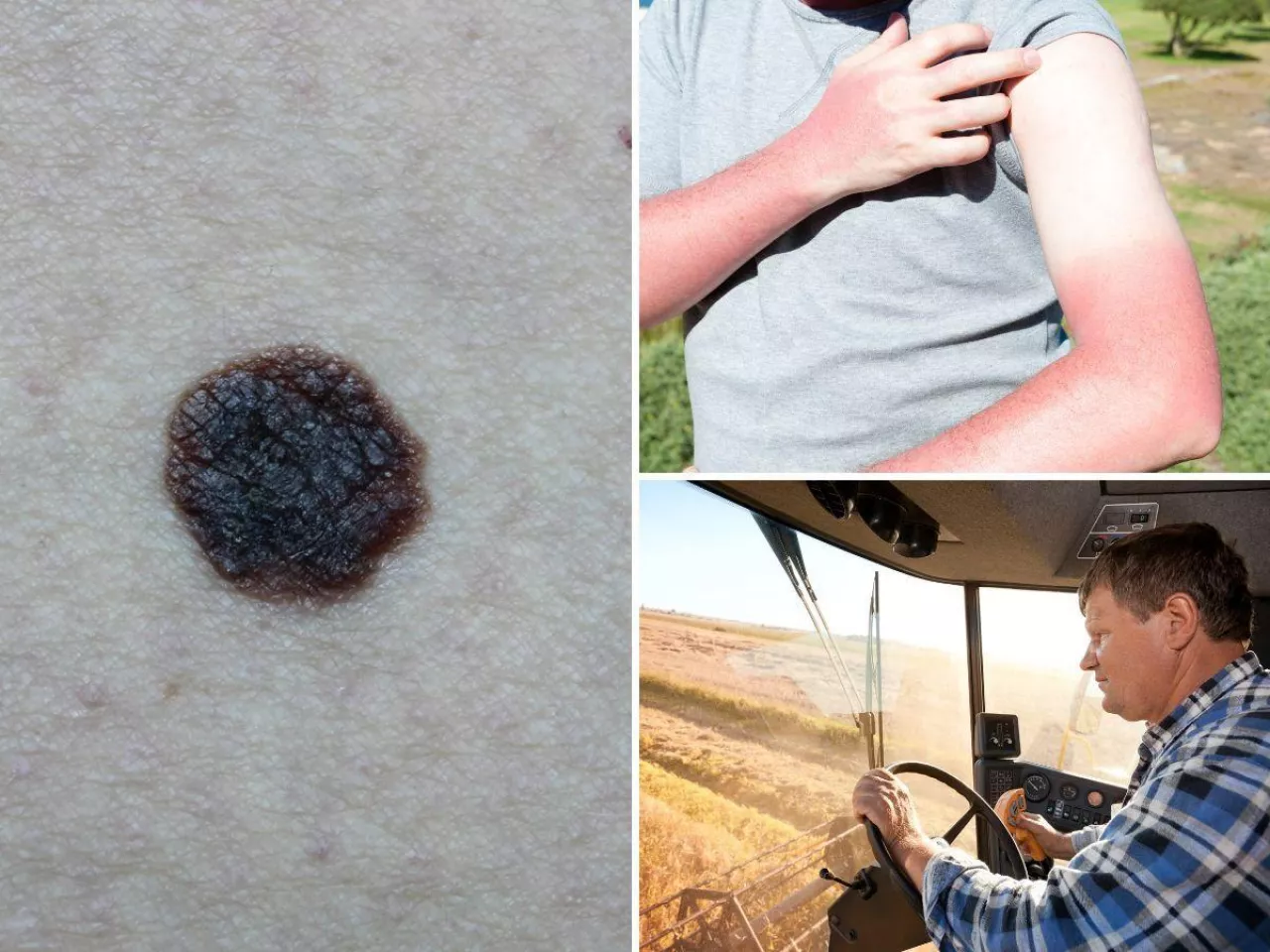 Żniwa kluczowe dla zdrowia rolników. Łatwo o śmiertelny nowotwór